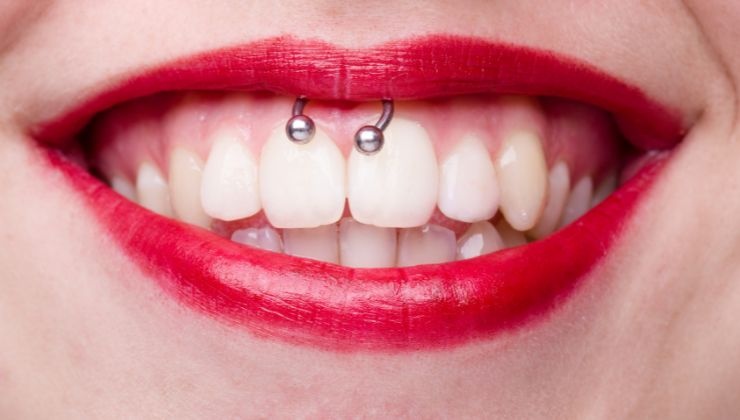 cosa devi sapere sullo smiley piercing e quanto fa male