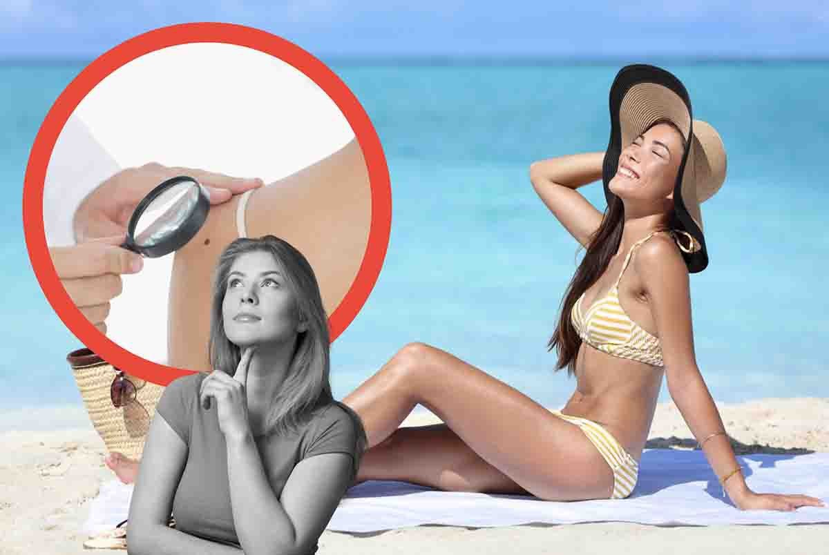 L'esposizione al sole aumenta il rischio di melanoma. La mappatura dei nei è essenziale