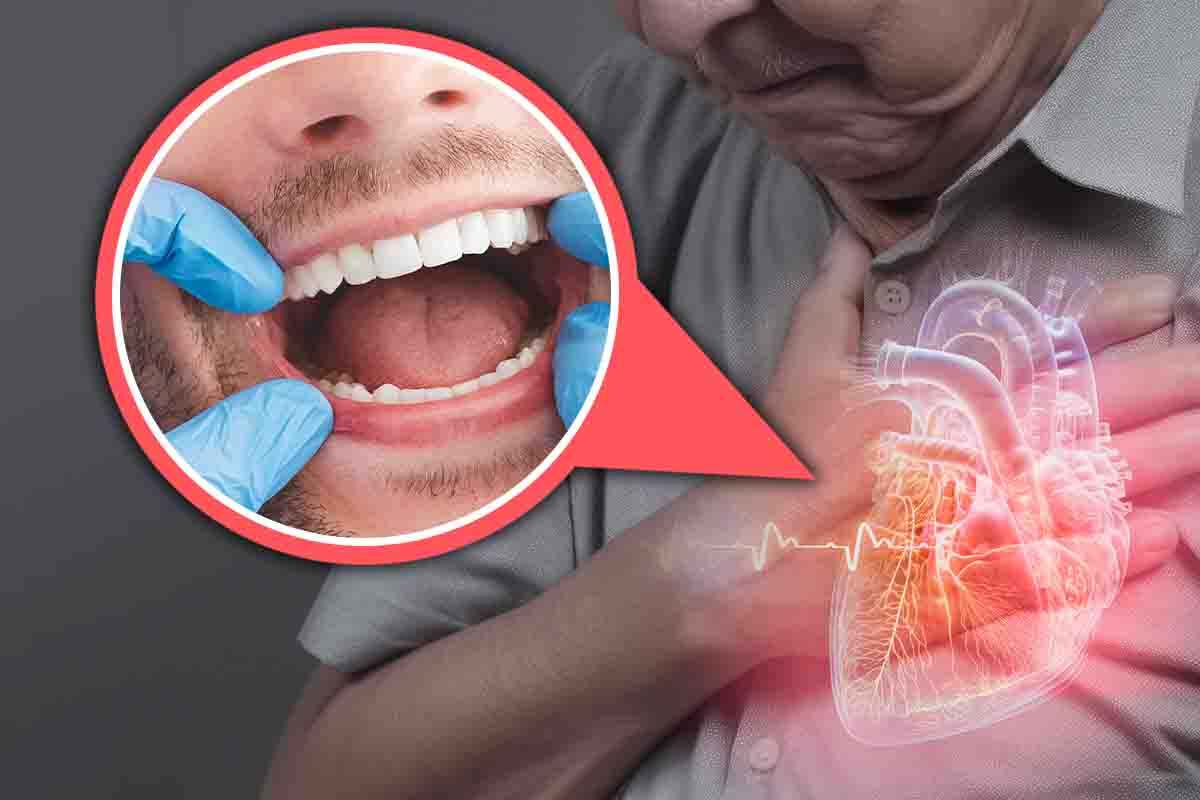 la salute del cuore dipende da quella dei denti