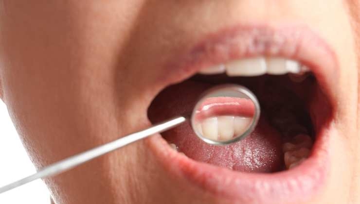 Prevenzione del tumore bocca con il test dello spazzolino