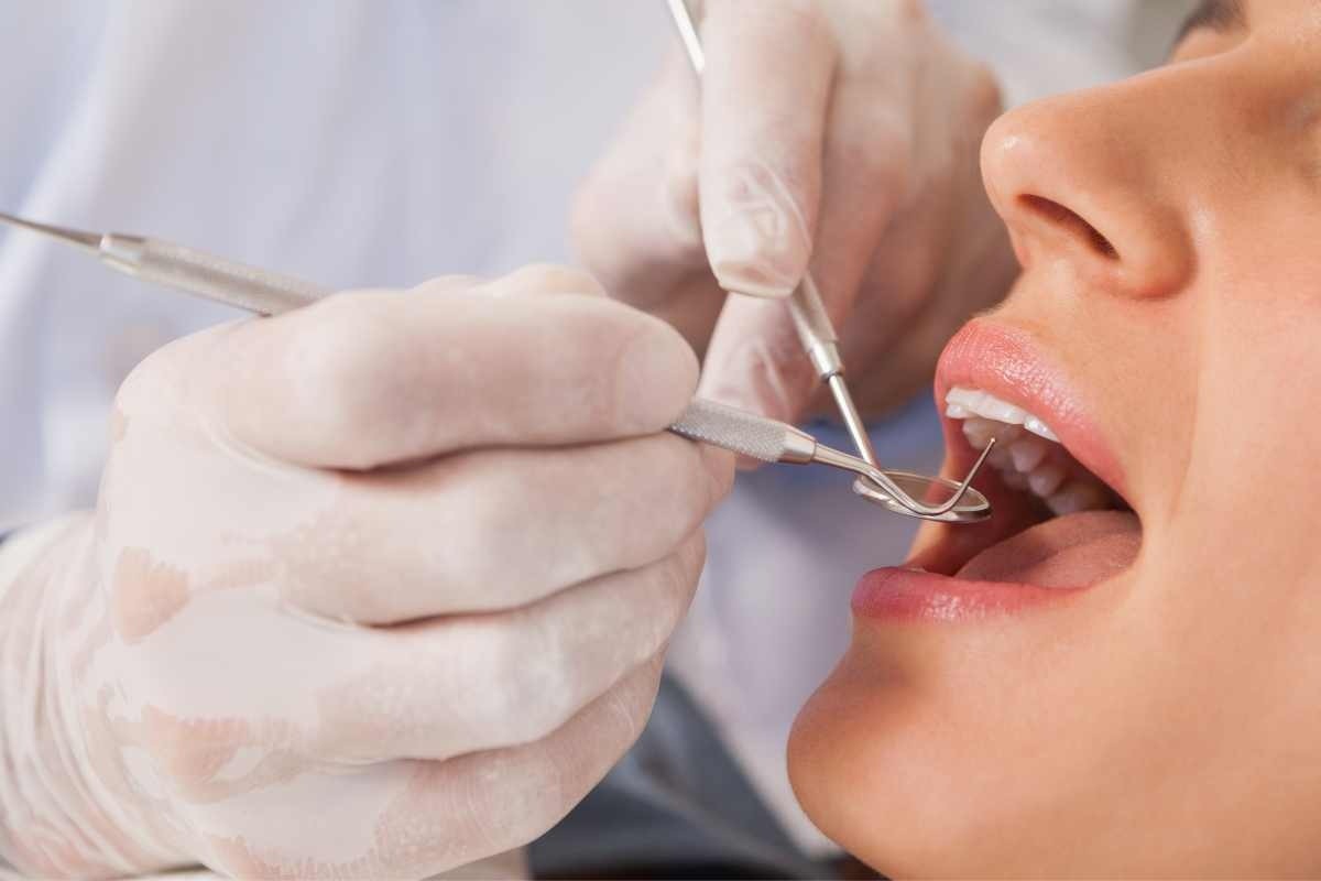 Da adesso puoi effettuare visite gratuite dal dentista: ecco come